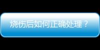 烧伤后如何正确处理？